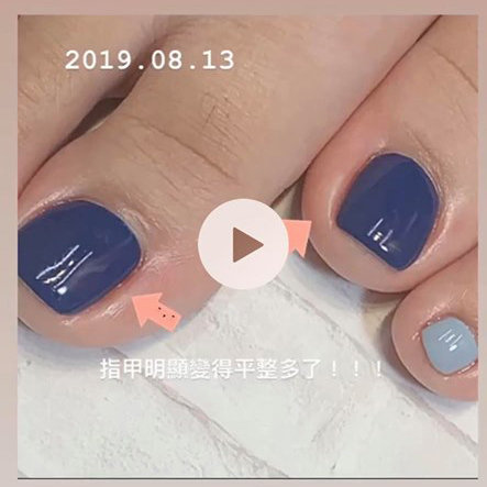 台中美甲推薦Minna Nail 美甲 崁甲矯正 封面