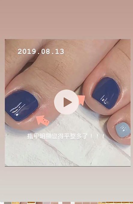 台中美甲推薦Minna Nail 美甲 崁甲矯正 0934 266 602台中市南屯區干城街277號 (4)